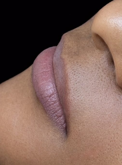 Antes da micropigmentação labial